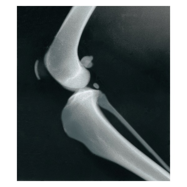 X-Ray Film, Blue Light Sensitive Standard Veterinary, For Use With: Portable Machines, 10 x 12 in