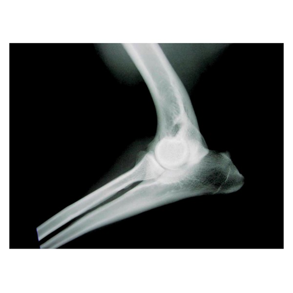 X-Ray Film, Green Light Sensitive Ultra Detail Plus, For Use With: Portable Machines, 14 x 17 in